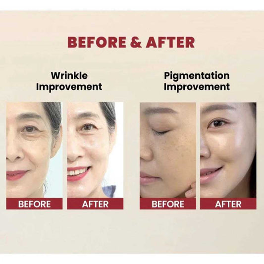 K-SECRET 1988 Retinal + Ginseng Serum (30ml)