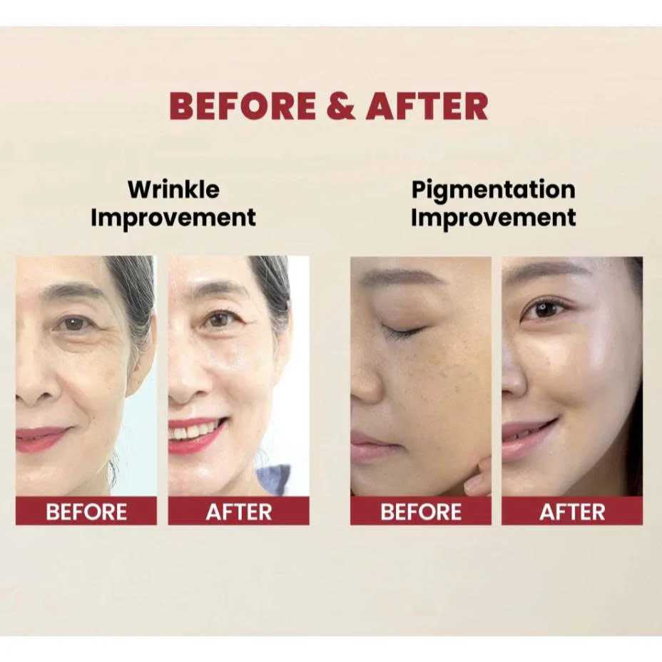 K-SECRET 1988 Retinal + Ginseng Serum (30ml)